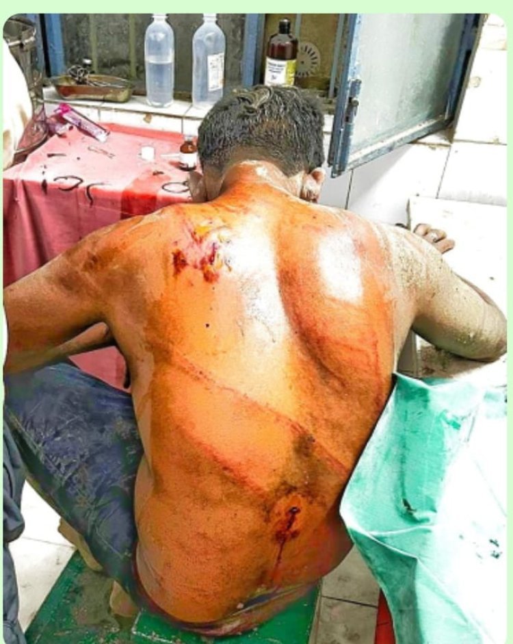 गोरखपुर: चौरीचौरा थाना क्षेत्र में ट्रक ड्राइवर पर हमला, पुलिस ने दो आरोपियों को पकड़ा