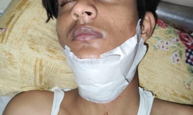 चाइनीज़ मांझे की चपेट में आया युवक, गर्दन पर लगे आधा दर्जन टांके