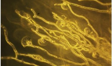 दवा वितरण पद्धति से फंगल संक्रमण उपचार में सुधार हो सकता है