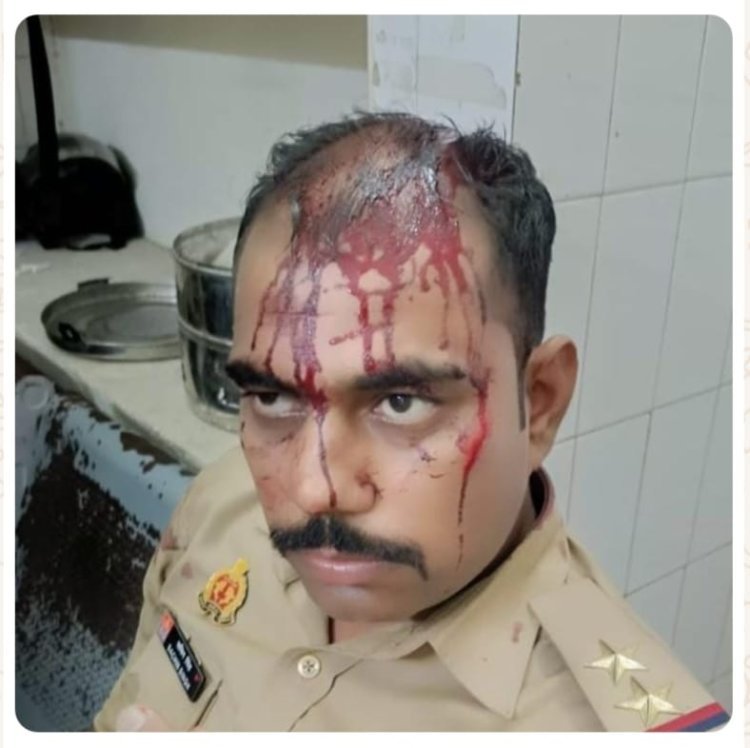 गोरखपुर में दुष्कर्म आरोपी की गिरफ्तारी के दौरान पुलिस पर हमला, दो पुलिसकर्मी गंभीर घायल