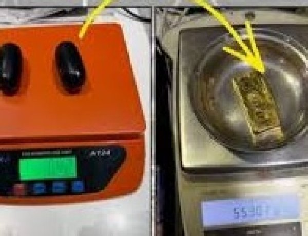 एयरपोर्ट पर हाईटेक तस्करी का खुलासा: महिला के शरीर में छिपा 83 लाख का सोना बरामद